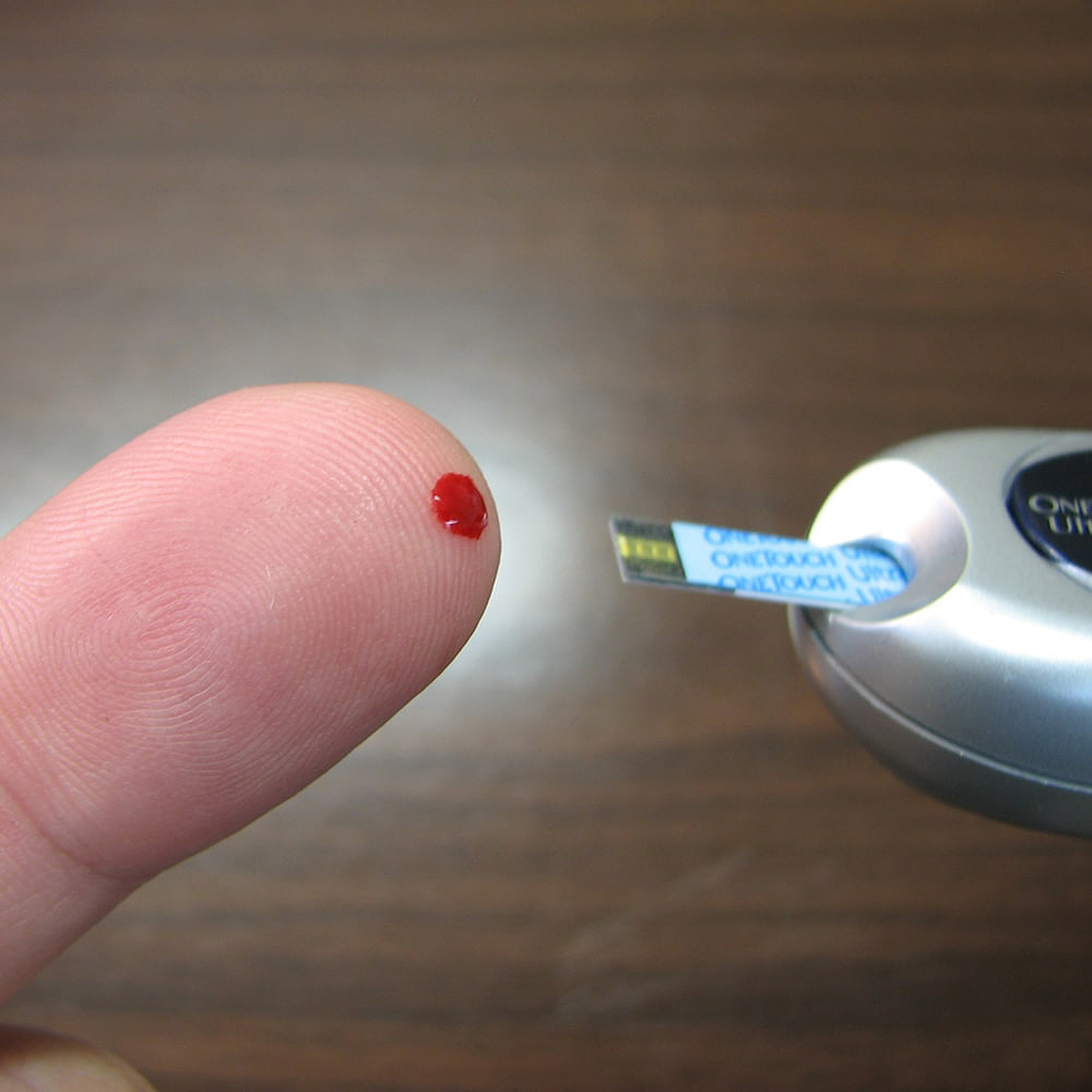 Why blood glucose monitoring?