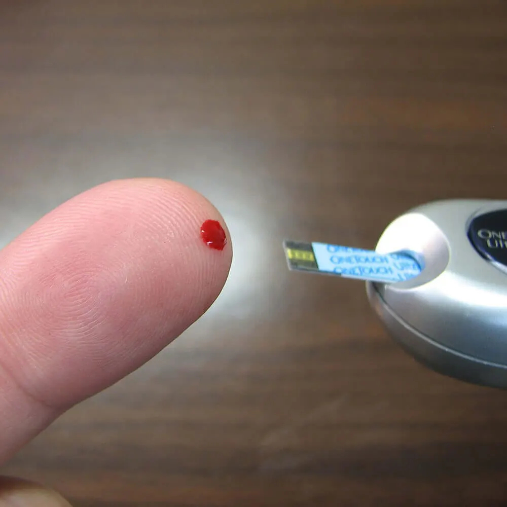 Why blood glucose monitoring?